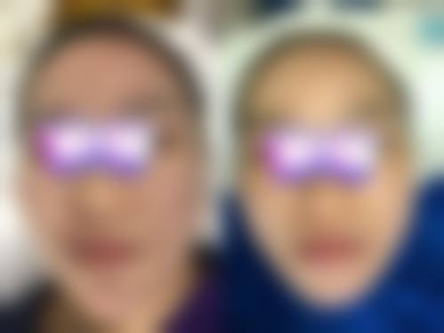 六、刘文静真实的患者评价