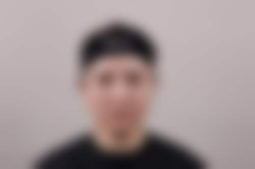 四、张农心医生擅长项目——热玛吉