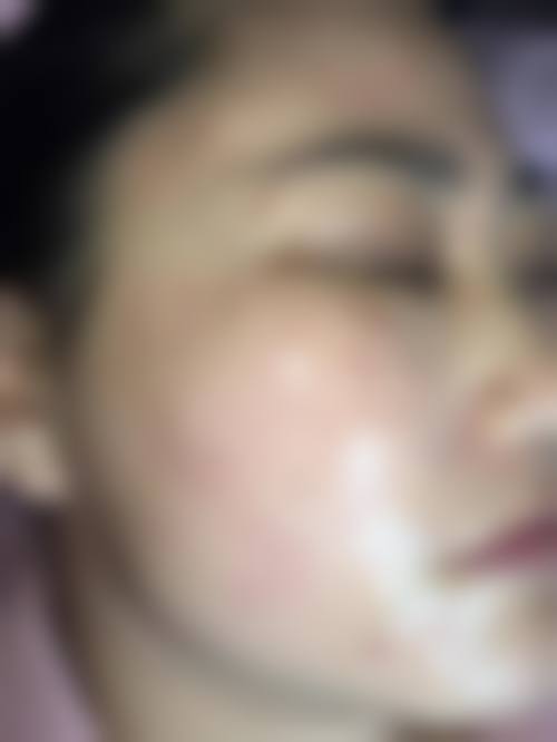 八、贵州利美康医院预约方式