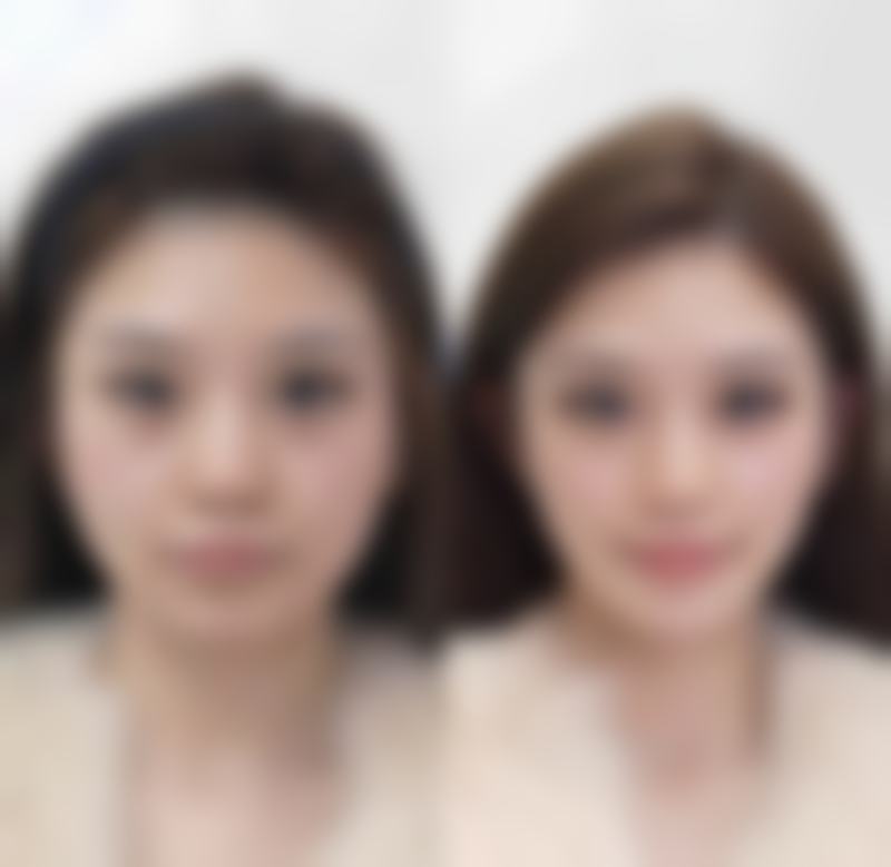二、赵金凤擅长项目
