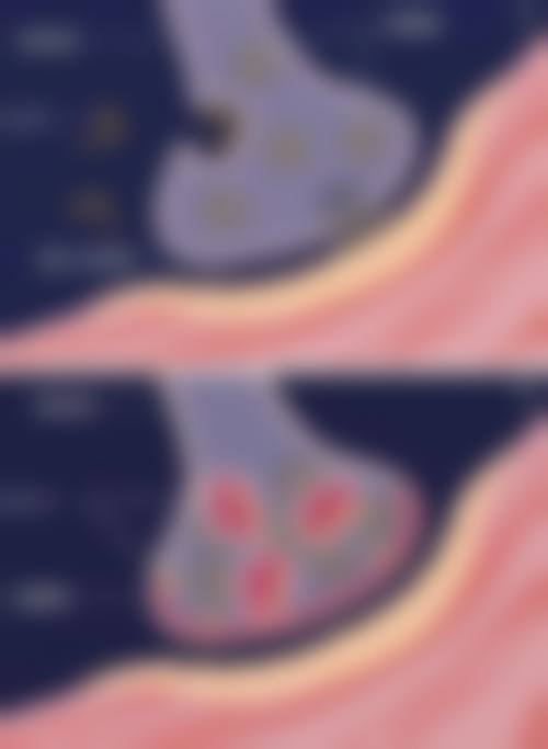 四、科学有效的去眼袋方法有哪些？