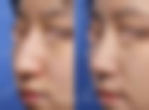 三、齐齐哈尔市第一医院(医疗美容科)诊疗项目有哪些？