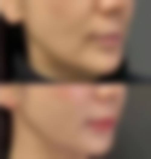 七、鸡西DrW王医生整形医院预约方式