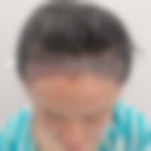 三、武汉大麦科发源微针植发医院诊疗项目有哪些？