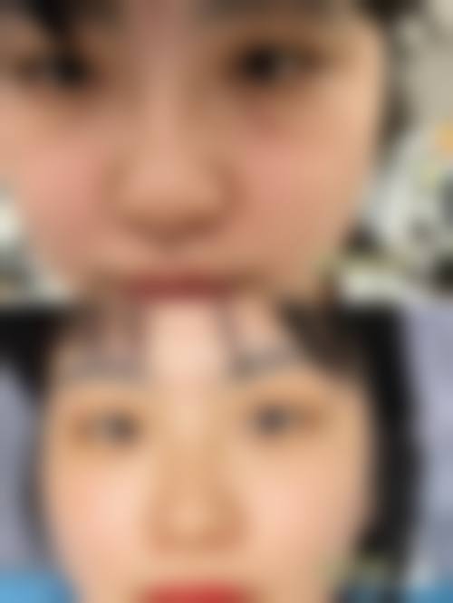 八、宁波海曙壬美医疗美容诊所真实的患者评价