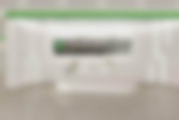 三、沈阳北方整形外科医院罗晓光手术成效见证