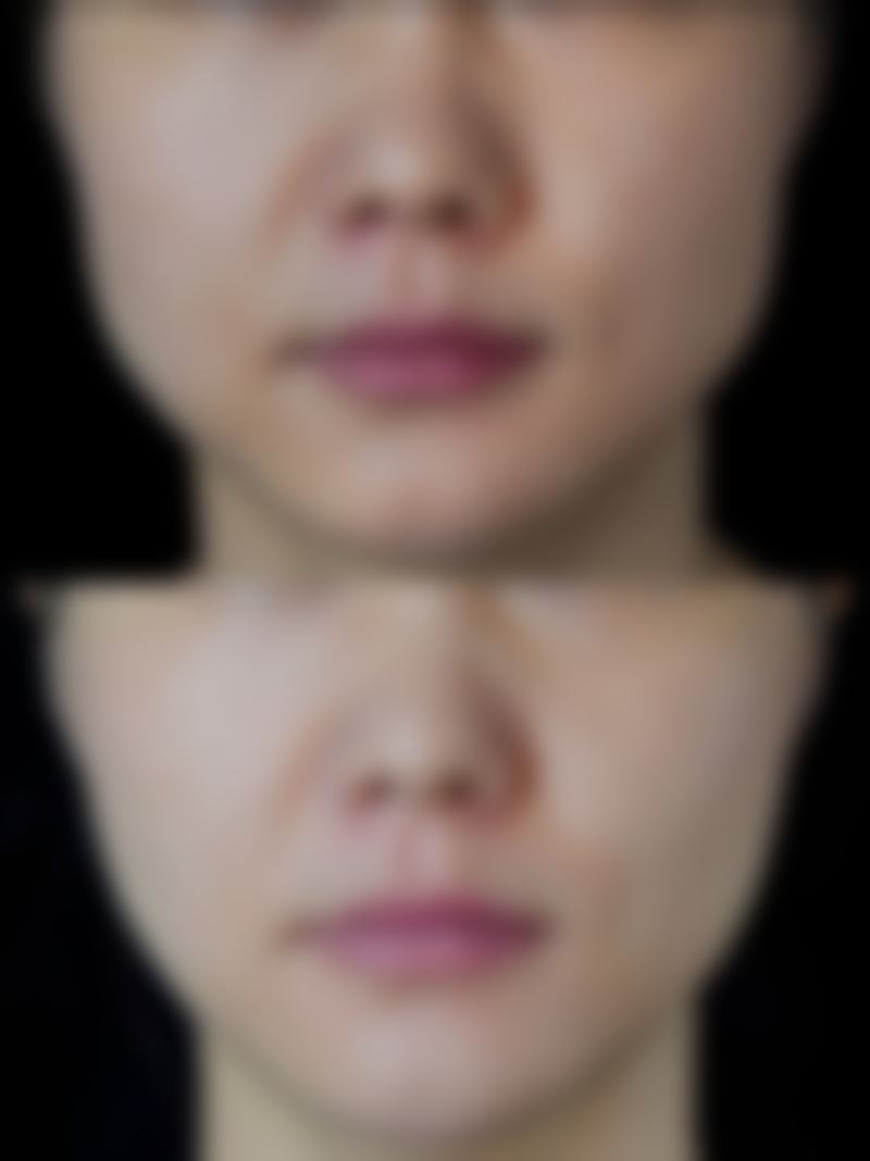 五、预防睡眠不足眼袋的方法