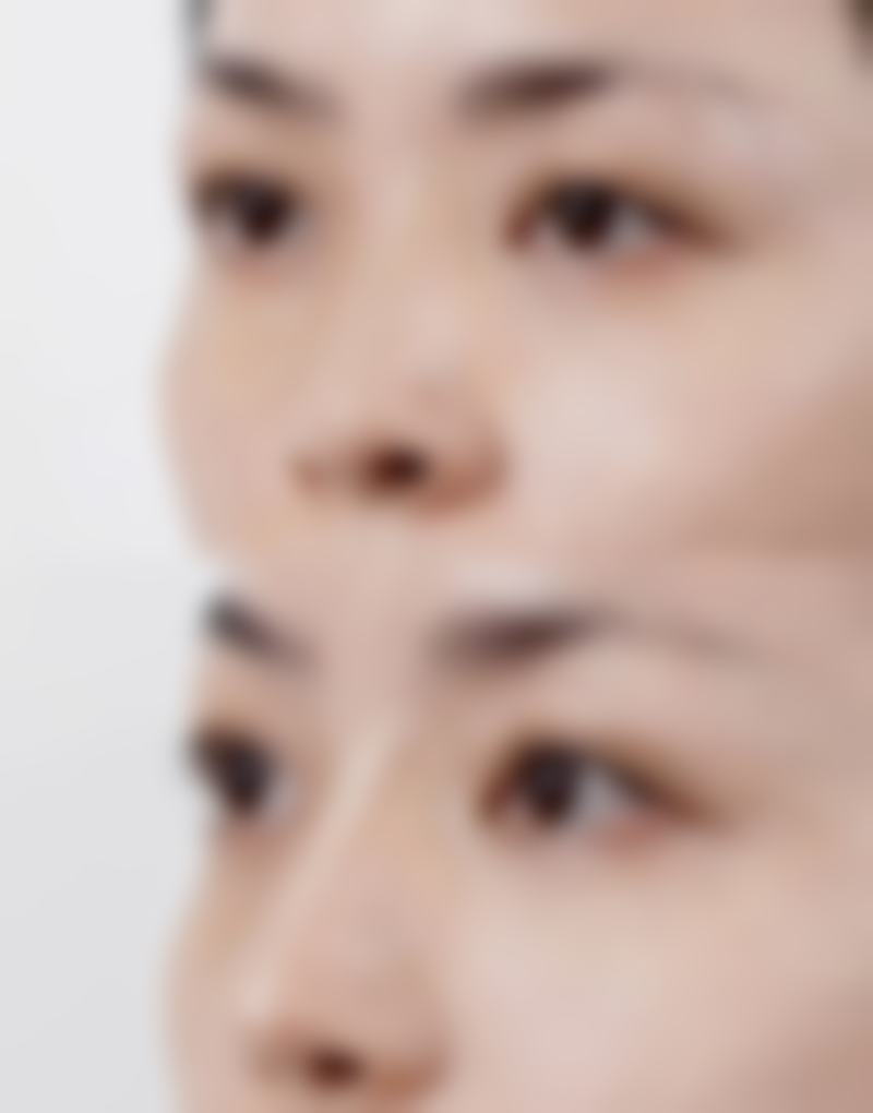 五、韩国 righthand 整形外科医生介绍