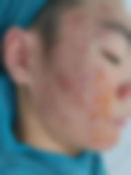二、盐城美逸医疗美容门诊部怎么样？