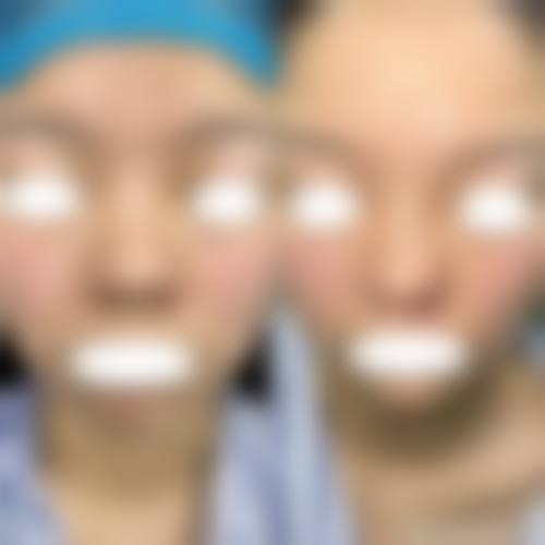 四、成都高新新瑞凯文医疗美容诊所特色项目