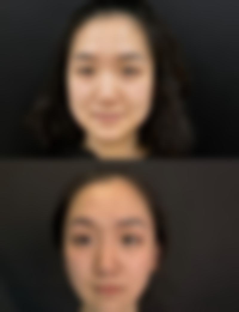 五、个人修复差异对洗澡洗头时间的影响