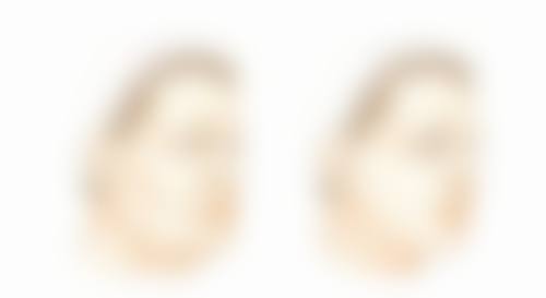 三、日常护理帮助消除孩子眼袋大