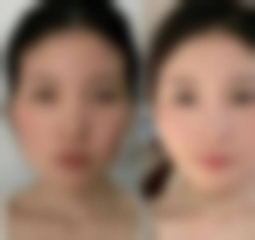 八、human皮肤科医院 龙山店真实的患者评价