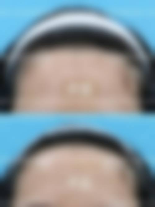 七、深圳米可医疗美容门诊部预约方式