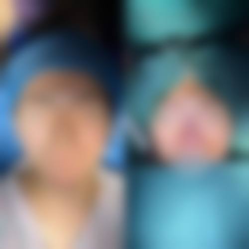 四、广东中山大学附属第二医院整形美容科特色项目