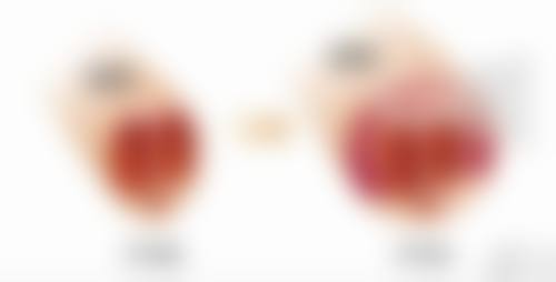 三、术后护理要点