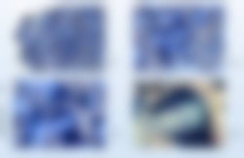 三、医美干预消除黑眼圈和眼袋