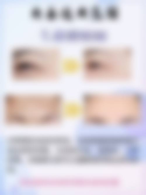 六、双眼皮下垂修复的成效评估