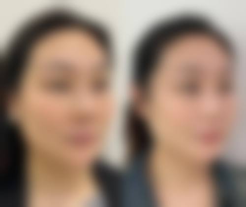 八、遂宁阳光丽人整形美容真实的患者评价