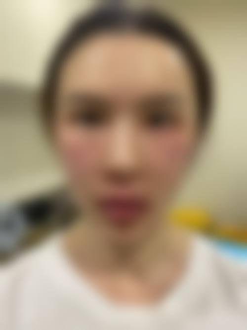 四、韩国鼻整形研究所特色项目