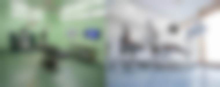 三、美国傲诺拉绚耀毛/水滴面假体的优势