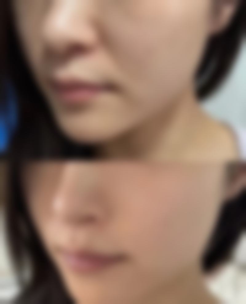 八、韩国365mc吸脂医院(大田院区)真实的患者评价