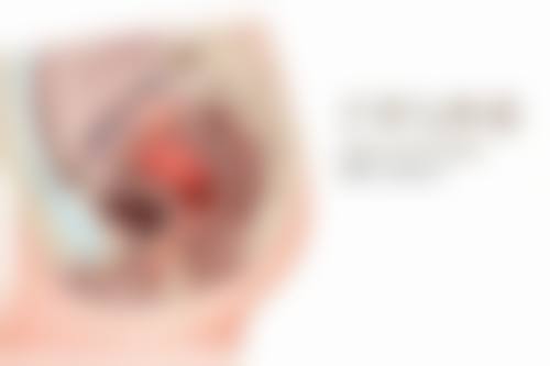 三、去眼袋手术可能存在的潜在风险