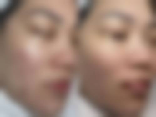 五、郑州康伦整形美容医院价格表
