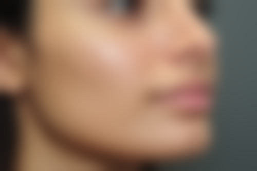八、三亚市人民医院(医学美容科)真实的患者评价