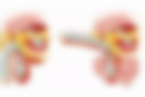 六、去眼袋改善泪沟的注意事项