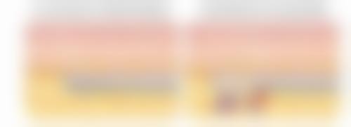 七、其他改善泪沟的方法