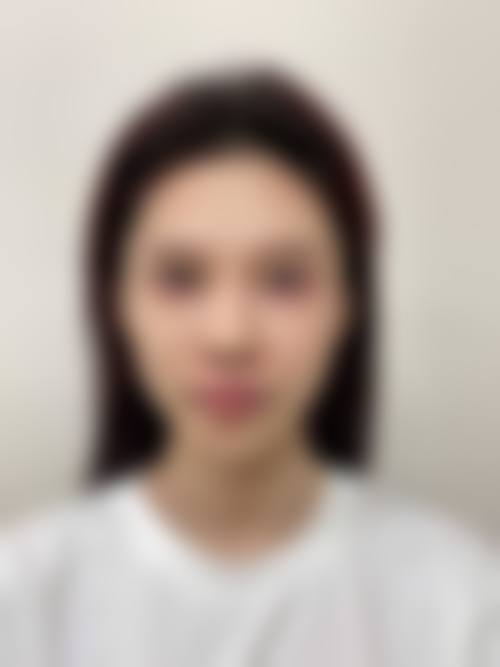 六、沈阳鑫美神整形医院价格表