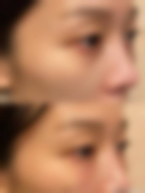 四、南昌红谷滩甄美医疗美容门诊部特色项目