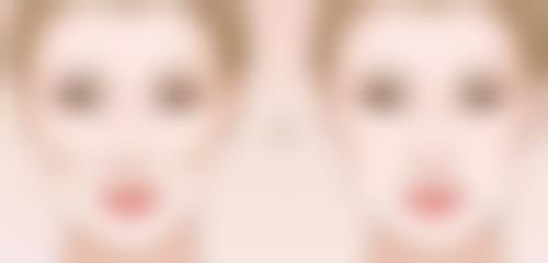 二、江南W眼科医院怎么样?