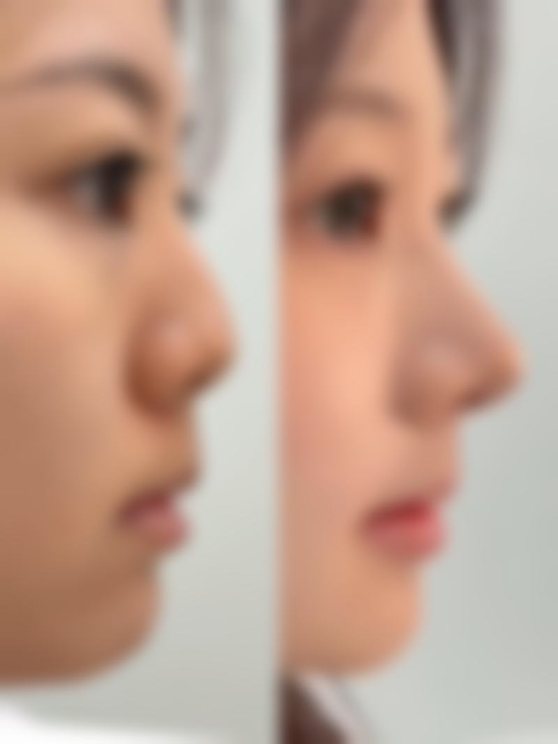 七、韩国THE CLASS整形医院地址及交通