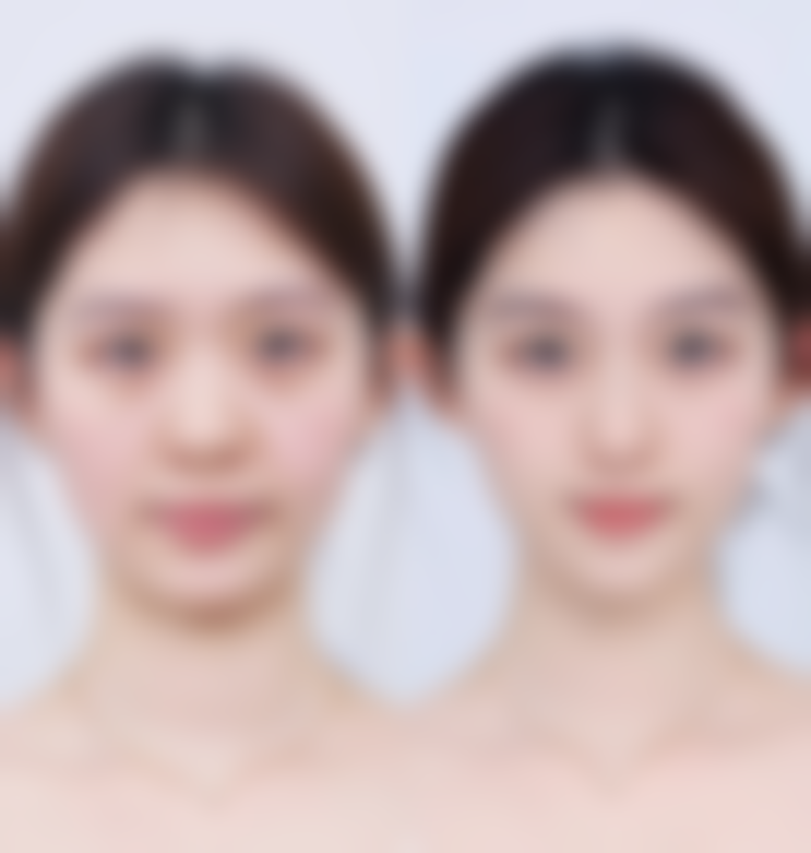 四、韩国THE CLASS整形医院特色项目