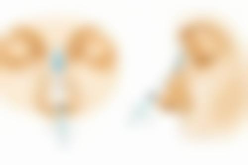 五、凸起疤痕如何祛除之手术治疗