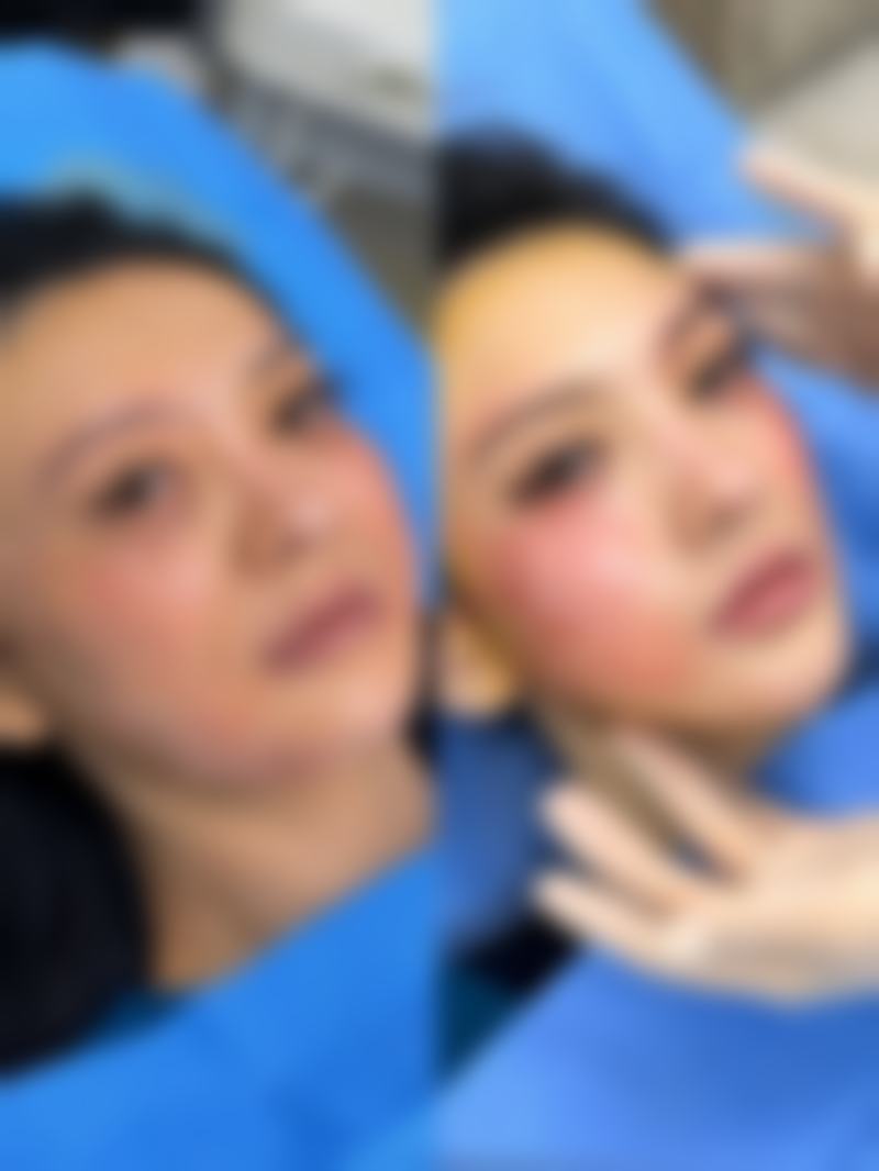 七、预防凸起疤痕的产生