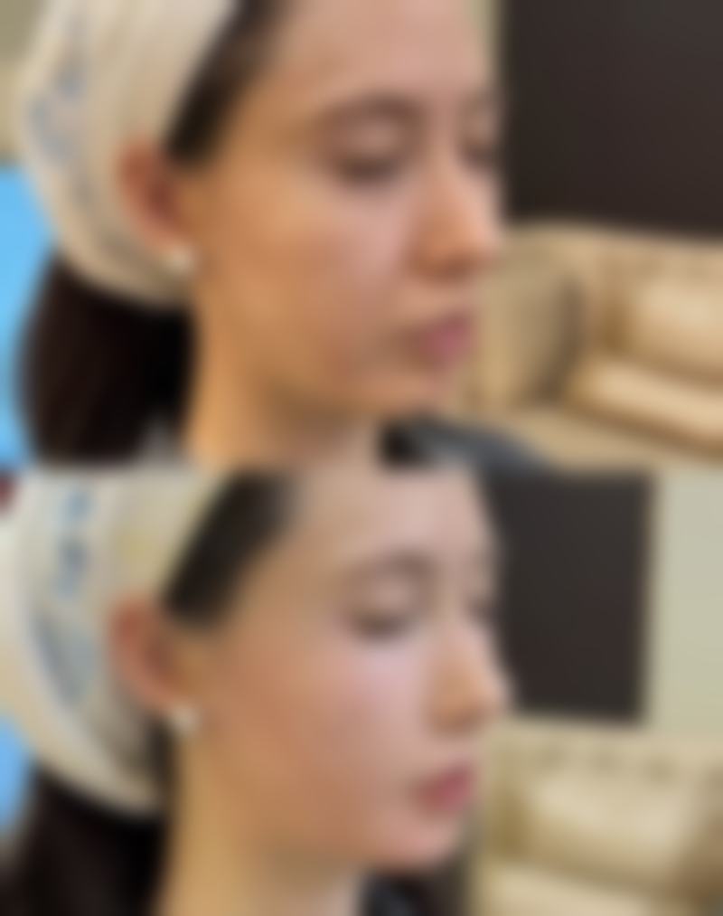 九、天津贝丽雅医疗美容诊所真实的患者评价