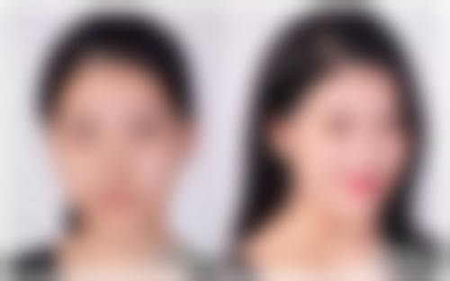 四、消除长期眼袋的日常小妙招