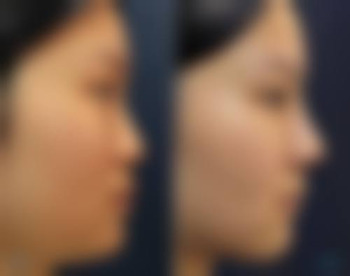 二、韩国1mm(一毫米)整形外科怎么样?