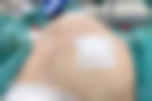 六、高健真实的患者评价