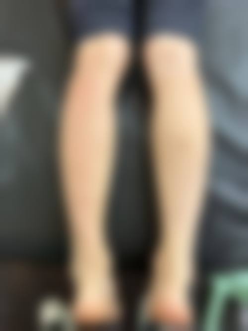 四、韩国1mm(一毫米)整形外科特色项目
