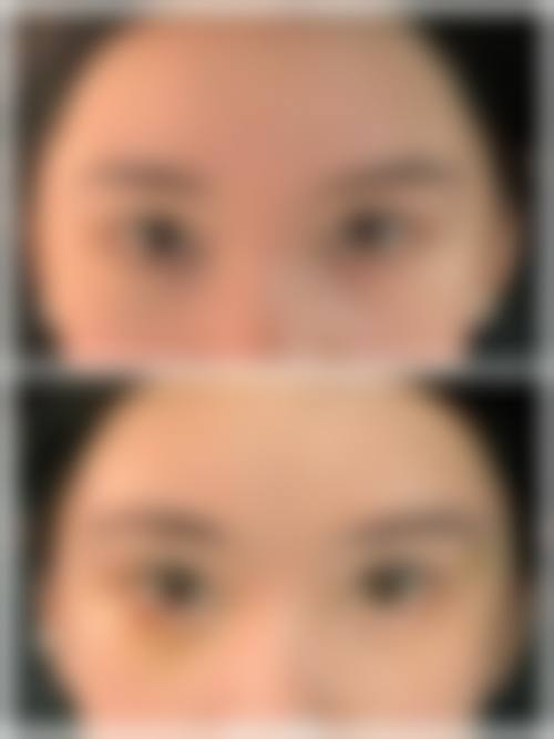 三、韩国1mm(一毫米)整形外科诊疗项目有哪些?