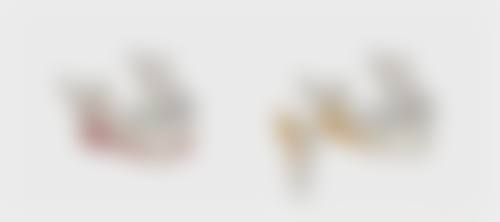 切除眼袋的疤痕多久才能好？揭秘影响恢复时间的因素及护理要点 
