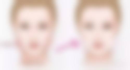 六、去眼袋是智商税吗？结尾总结