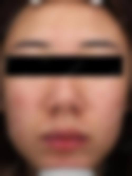四、济宁兰积整形医院特色项目
