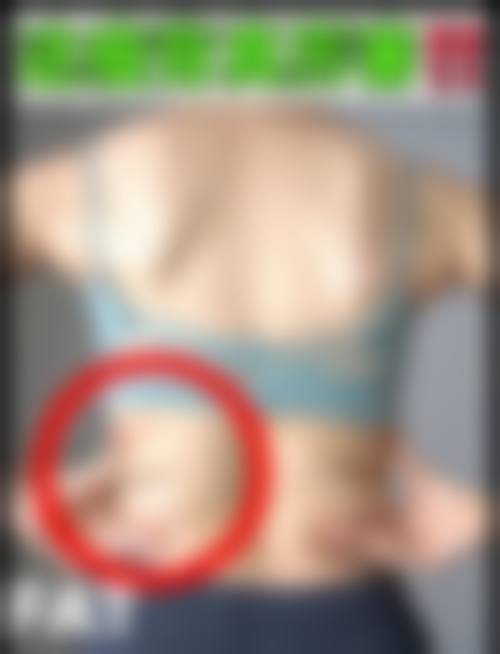 四、陕西阿狸佑美医疗美容诊所特色项目