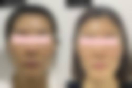 七、南京柏羽医疗美容医院预约方式