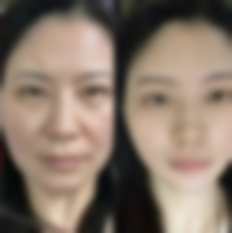 瘦脸针在常温下可以放多久？了解保存时长，还能知晓打一次维持多久！ 